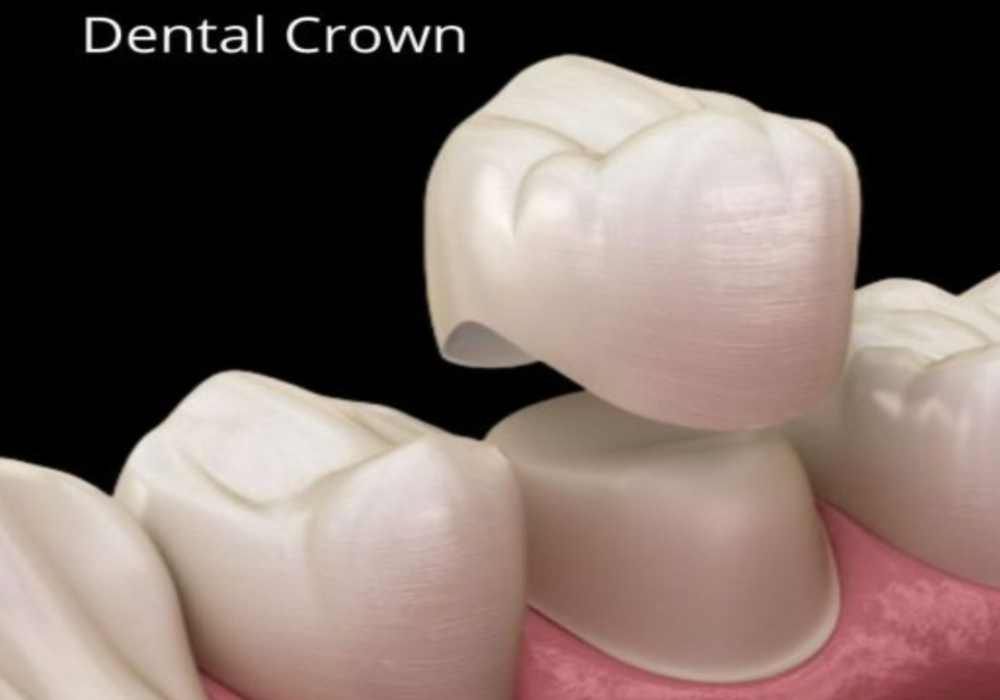 Why do we need to do a dental crown on tooth after Root Canal Treatment?